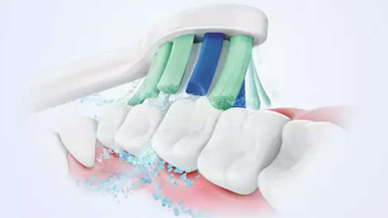 Bàn chải điện sonic Philips HX3641/41 - Hàng chính hãng