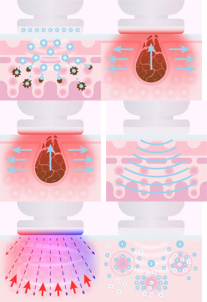 Máy điện di đẩy tinh chất và chăm sóc da Lanaform PureSkin LA131312 - Hàng chính hãng