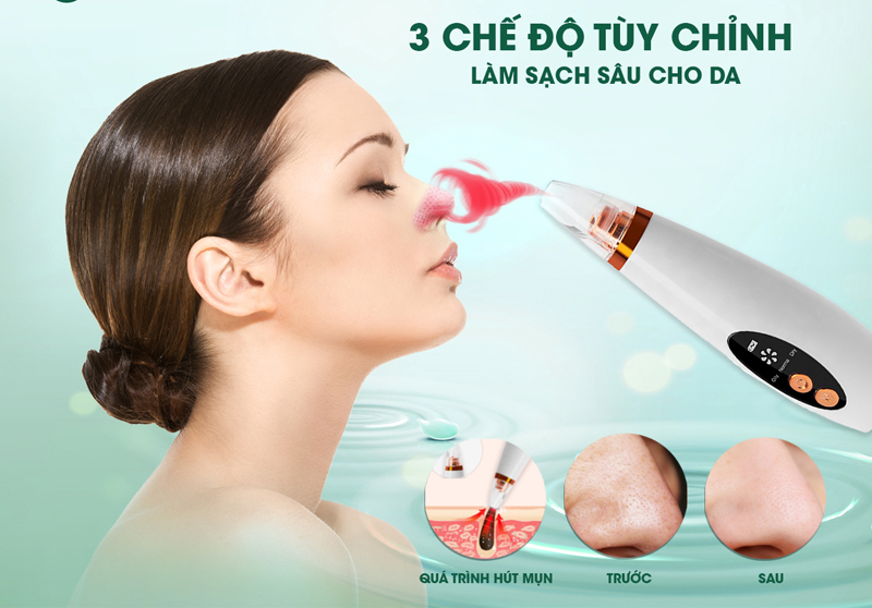 Máy hút mụn đầu đen Fuji Master FJM-1922 - Hàng chính hãng