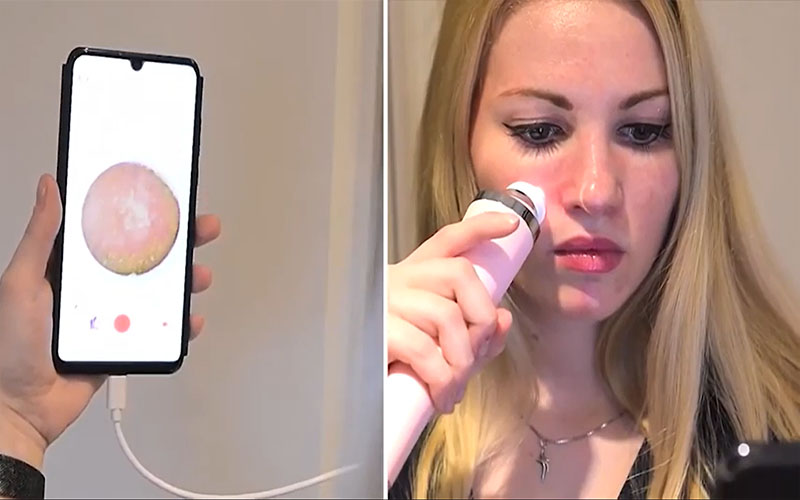 Máy soi da hút mụn tích hợp camera Rio DRMC - Hàng chính hãng