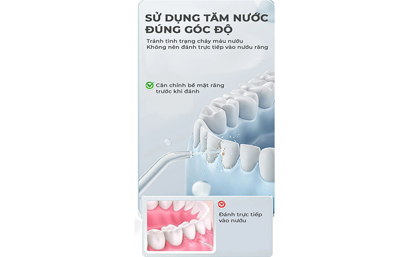 Máy tăm nước Magic Eco PRO-81 - Hàng chính hãng